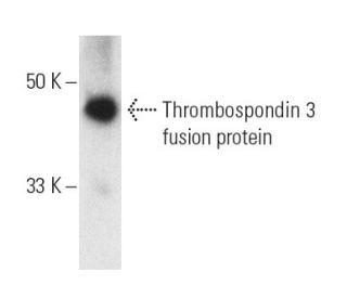 Thrombospondin 3 Antibody (A-12) - Western Blotting - Image 6169 