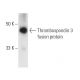 Thrombospondin 3 Antibody (A-12) - Western Blotting - Image 6169 