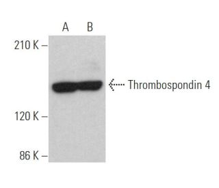 Thrombospondin 4 Antibody (F-7) - Western Blotting - Image 368356Each CRISPR/Cas9 Knockout (KO) Plasmid product consists of a pool of 3 plasmids designed to ensure identification and cleavage of a specific gene for maximum knockout efficiency. Each plasmid encodes a unique 20 nt sequence derived from the GeCKO (v2) library.