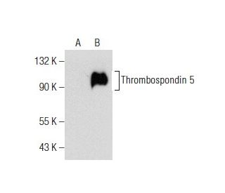 Thrombospondin 5 Antibody (F-7) - Western Blotting - Image 155159
