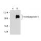 Thrombospondin 5 Antibody (F-7) - Western Blotting - Image 155159