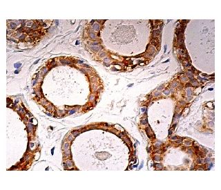 ThrRS Antibody (C-3) - Immunohistochemistry - Image 159022 
