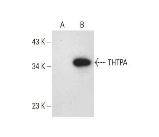 THTPA Antibody (A-11) - Western Blotting - Image 311741