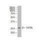 THTPA Antibody (SQ-30) - Western Blotting - Image 33730