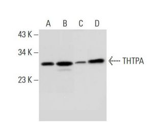 THTPA Antibody (SQ-30) - Western Blotting - Image 306225 