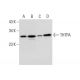 THTPA Antibody (SQ-30) - Western Blotting - Image 306225 