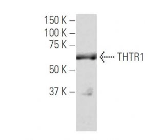 THTR1 Antibody (R-5) - Western Blotting - Image 34018