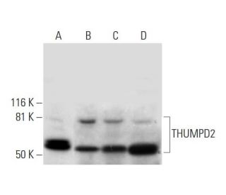 THUMPD2 Antibody (D-11) - Western Blotting - Image 291967 