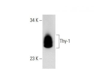 Thy-1/CD90 Antibody (T24/31) - Western Blotting - Image 68076 
