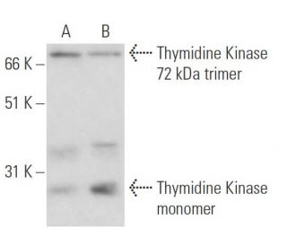 Thymidine Kinase Antibody (3B3.E11) - Western Blotting - Image 17541 