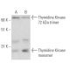 Thymidine Kinase Antibody (3B3.E11) - Western Blotting - Image 17541 