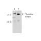 Thymidine Kinase Antibody (3B3.E11) - Western Blotting - Image 132080