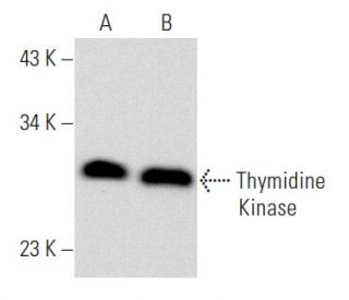Thymidine Kinase Antibody (C-4) - Western Blotting - Image 358019 