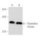 Thymidine Kinase Antibody (C-4) - Western Blotting - Image 358019 