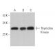 Thymidine Kinase Antibody (C-4) - Western Blotting - Image 364032