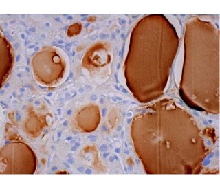 Thyroglobulin Antibody (1D4) - Immunohistochemistry - Image 293418 