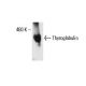 Thyroglobulin Antibody (1D4) - Western Blotting - Image 17789