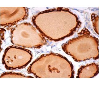 Thyroperoxidase Antibody (MoAb47) - Immunohistochemistry - Image 384126 