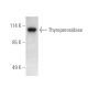 Thyroperoxidase Antibody (MoAb47) - Western Blotting - Image 389361