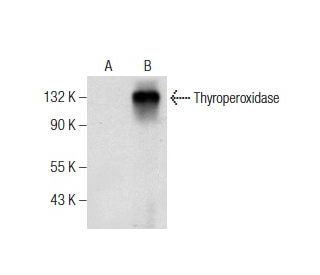 Thyroperoxidase Antibody (A-5) - Western Blotting - Image 160870Each CRISPR/Cas9 Knockout (KO) Plasmid product consists of a pool of 3 plasmids designed to ensure identification and cleavage of a specific gene for maximum knockout efficiency. Each plasmid encodes a unique 20 nt sequence derived from the GeCKO (v2) library.