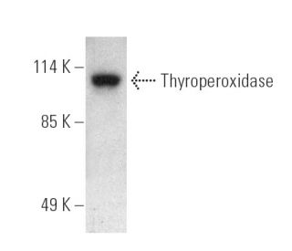 Thyroperoxidase Antibody (MoAb47) - Western Blotting - Image 389361