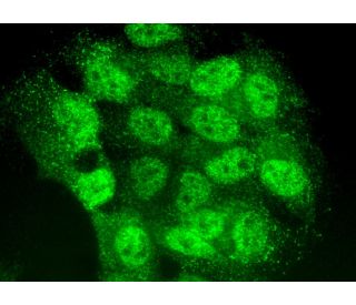 TIA-1 Antibody (C-10) | SCBT - Santa Cruz Biotechnology