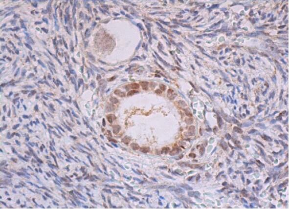 nacoページ TIA-1 Antibody (C-10) | SCBT - Santa Cruz Biotechnology