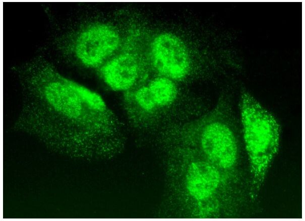 TIA-1抗体(G-3) | SCBT - Santa Cruz Biotechnology