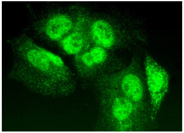 TIA-1 Antibody (G-3) | SCBT - Santa Cruz Biotechnology