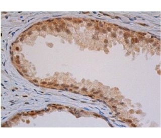 tia-1-antibody-g-3-