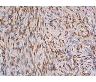 Toruさま購入品 Tensor De Tiempo /Timing Adjuster 16620-0W131 Alternator