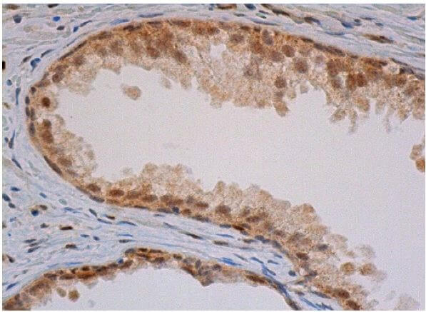 ラスカル様 写真確認出品 計20枚(13枚目、14枚目の写真) TIA-1抗体(G-3) | SCBT - Santa Cruz Biotechnology