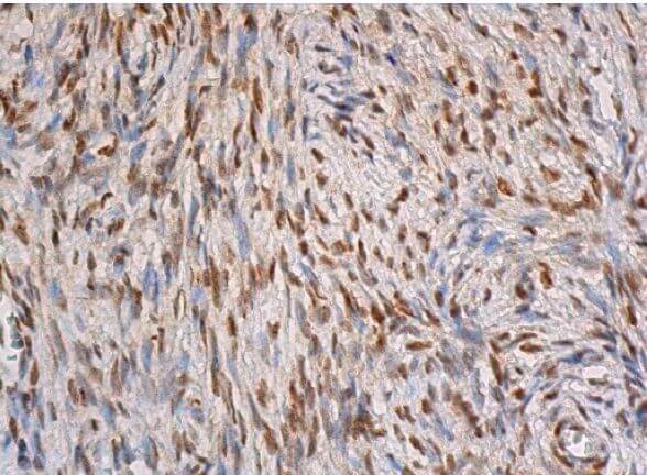 TIA-1 Antibody (G-3) | SCBT - Santa Cruz Biotechnology