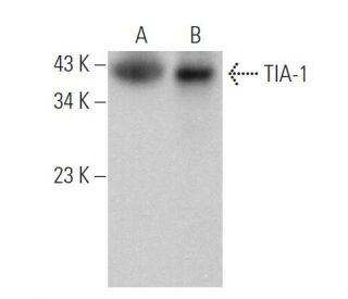 ゆ様　ご確認用 TIA-1抗体(G-3) | SCBT - Santa Cruz Biotechnology