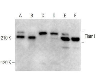 western blotting image from recommended Tiam1 (E-7) monoclonal antibody replacement. Image 378682