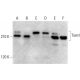 This polyclonal antibody has been discontinued. See our recommended <a href="tiam1-antibody-e-7">Tiam1 (E-7)</a> monoclonal antibody (sample data shown). western blotting image from recommended Tiam1 (E-7) monoclonal antibody replacement. Image 378682