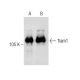 Tiam1 Antibody (F-11) - Western Blotting - Image 283648 