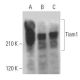 Tiam1 Antibody (F-11) - Western Blotting - Image 359185 