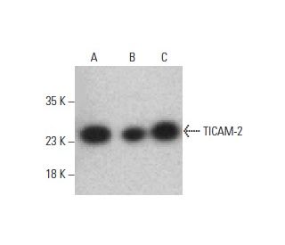 TICAM-2 Antibody (E-2) - Western Blotting - Image 395681 