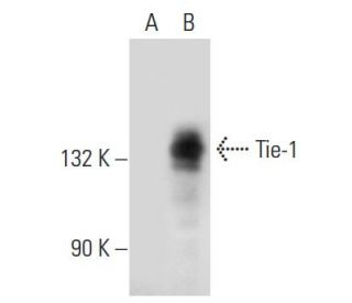Tie-1 Antibody (12D9) - Western Blotting - Image 32733