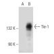 Tie-1 Antibody (12D9) - Western Blotting - Image 32733