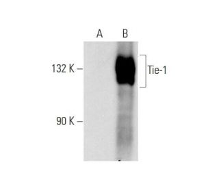 western blotting image from recommended Tie-1 (G-12) monoclonal antibody replacement. Image 145582