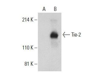 Tie-2 Antibody (F-8) - Western Blotting - Image 397678