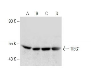 TIEG1 Antibody (95-D) - Western Blotting - Image 139032 