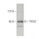 TIEG2 Antibody (32) - Western Blotting - Image 396391