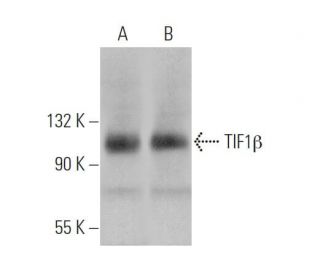 TIF1&beta; Antibody (D-7) - Western Blotting - Image 375895Each CRISPR/Cas9 Knockout (KO) Plasmid product consists of a pool of 3 plasmids designed to ensure identification and cleavage of a specific gene for maximum knockout efficiency. Each plasmid encodes a unique 20 nt sequence derived from the GeCKO (v2) library. 