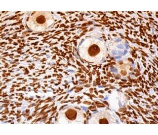 #213　自信過剰、、、！？　PSA7 過ヨウ素酸 SAJ special grade, ≥98.5% | Sigma-Aldrich