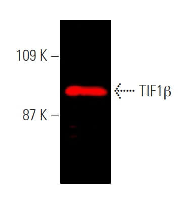 TIF1β抗体(D-7) | SCBT - Santa Cruz Biotechnology