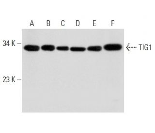 TIG1 Antibody (G-2) - Western Blotting - Image 311905 