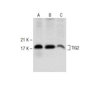 TIG2 Antibody (E-7) - Western Blotting - Image 148003 